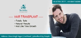 Hair Transplant in Amritsar