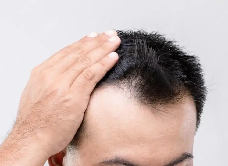fue hair transplant in jalandhar